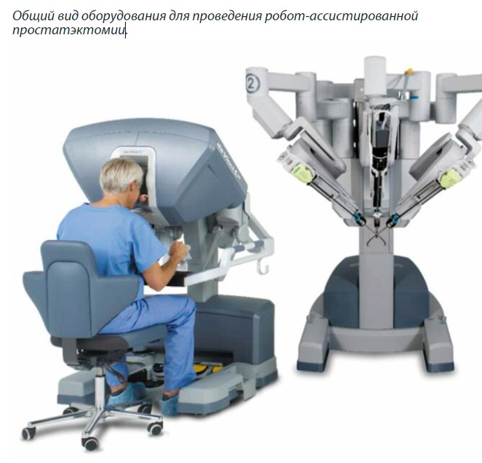 Вид оборудования для проведения робот-ассистированной простатэктомииид оборудования для проведения робот-ассистированной.jpg